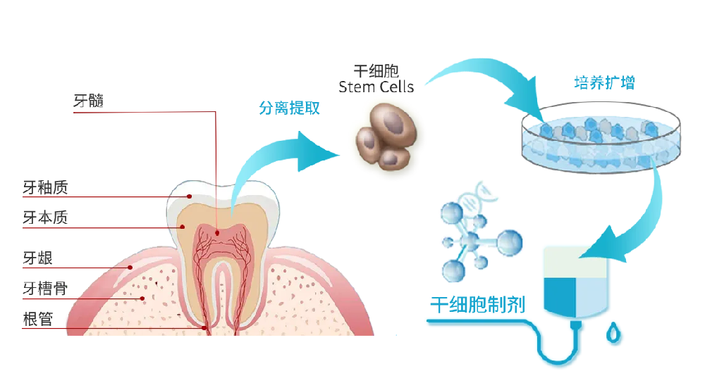 拔掉的牙齒可以用來儲(chǔ)存牙髓干細(xì)胞嗎？